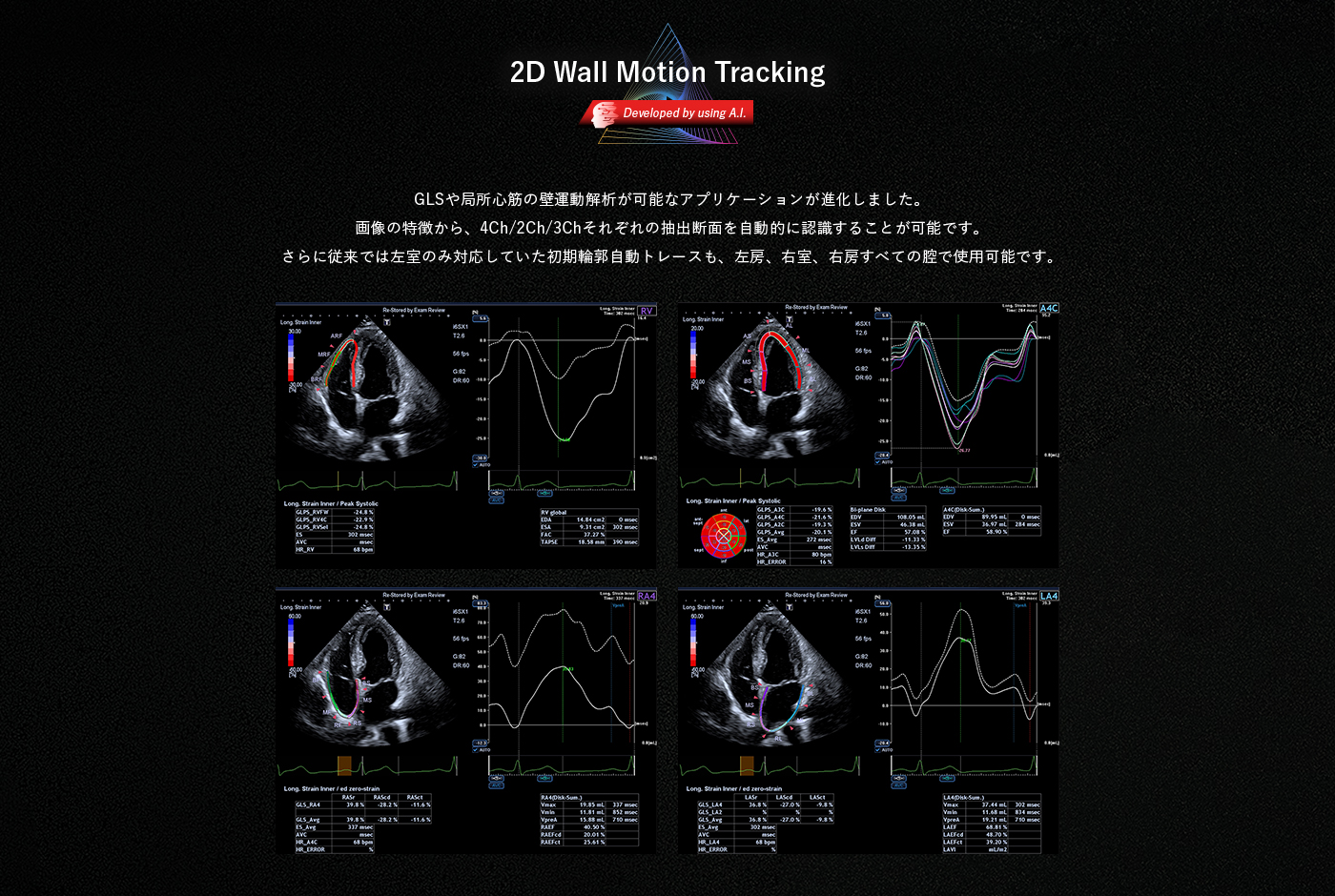 2D Wall Motion Tracing