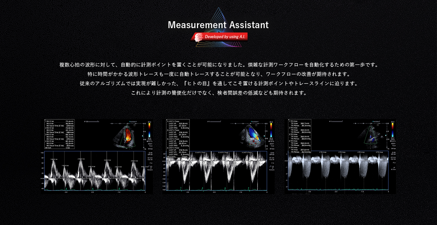 Measurement Assistant